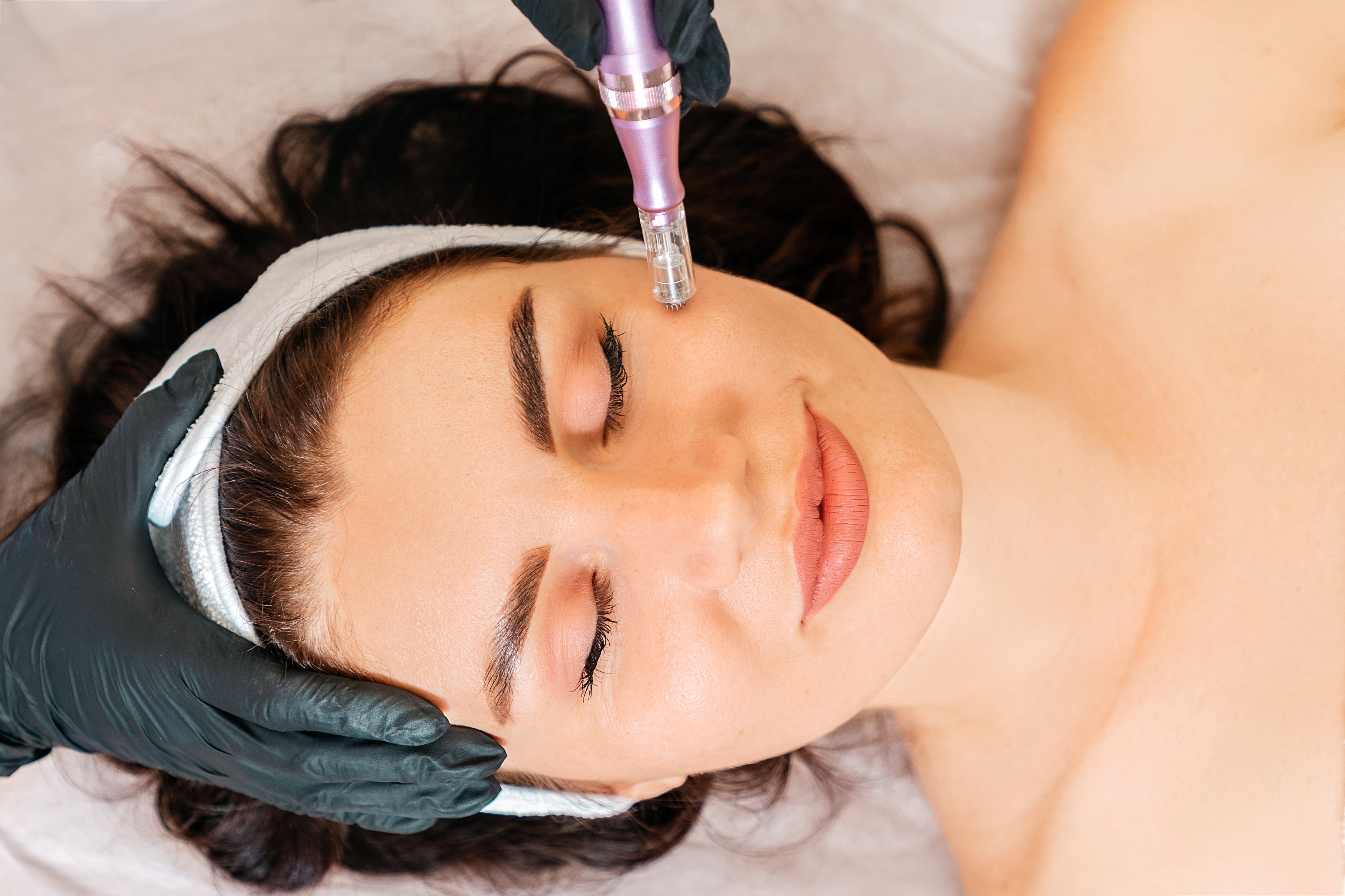 Microneedling At Bayridge Beauty