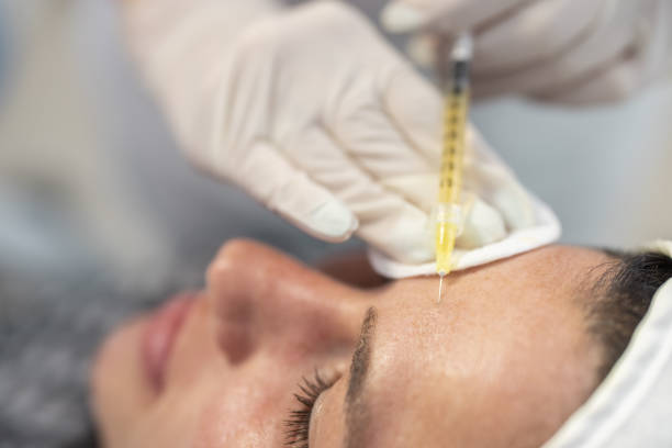 PRP Microneedling At Bayridge Beauty